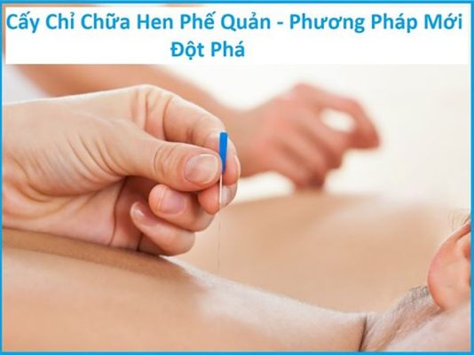 Cấy chỉ điều trị hen phế quản hiệu quả không? Chi phí như nào?
