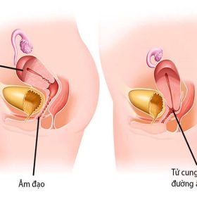Khám sa tử cung như thế nào? Địa chỉ thăm khám uy tín