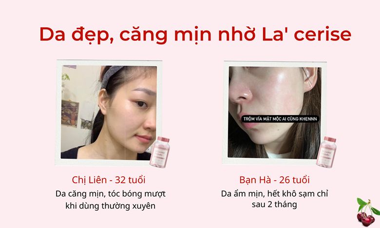 Review viên uống đẹp da La' Cerise chi tiết thành phần, công dụng