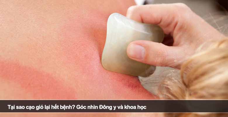 Tại sao cạo gió lại hết bệnh? Góc nhìn Đông y và khoa học
